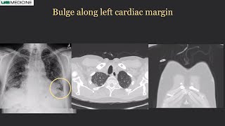 RSNA 2021: Dynamic Digital Radiography in Chest Imaging | Konica Minolta Healthcare