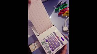 How to use ECG MACHINE, Clarity 6 channel Ecg TrueBeat 100H Demo.