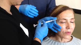 Advanced Dermal Filler s with Dr. Michael Lum