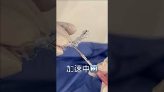 兒童隱適美沒有空間讓恆牙長出來怎麼辦？｜【祐民牙醫－隱適美旗艦店】鑽石級楊大為醫師 #兒童矯正 #剪牙套