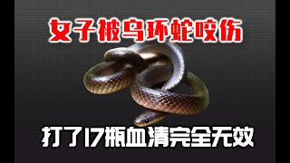 22岁女子被乌环蛇咬伤！打了17瓶抗毒血清都没用？转院途中不幸身亡！