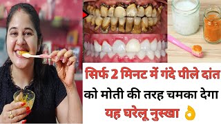 सिर्फ 2 मिनट में पीले गंदे दांतों को मोती की तरह चमका देगा यह घरेलू नुस्खा ! White teeth home remedy