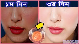 রাতে মাত্র ১ বার ব্যবহারে ত্বক ফর্সা হবেই হবে How To Get Fair Skin in 1 to 3 Days