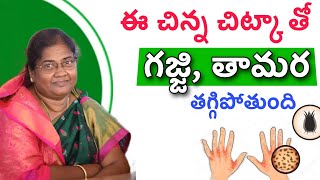 గజ్జి, తామర సమస్యకు చిట్కా| scabbies problem Home Remedy #teluguhealthtips #teluguayurvedam