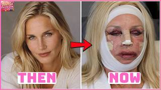 35 Celebrity Transformations So Extreme They're Shocking | Before & After 2026