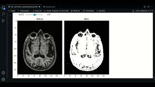 2.4 - Denoise, Blurring, Thresholding | SimpleITK - Course MRI preprocessing with Python