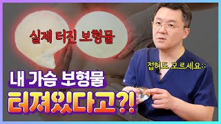 가슴 보형물이 터지는 이유!ㅣ보형물파손, 보형물파열ㅣ