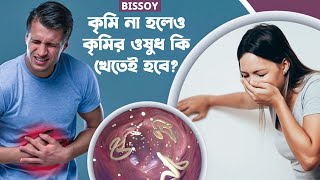 কৃমি না হলেও কি কৃমির ওষুধ খেতে হবে? কৃমির ওষুধ খাওয়ার সঠিক নিয়ম কি?