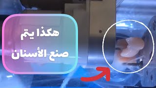 شاهد كيف يتم صناعة الأسنان (القشور)  بتقنية عالية جدأ SIRONA CEREC MC XL