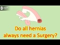 Do all hernias always need a Surgery? - Dr. Nanda Rajaneesh