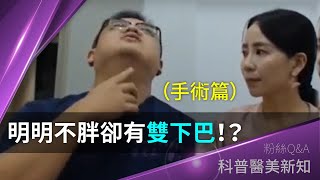 明明不胖，卻有「雙下巴」！如何才能消除肥厚下巴？【手術篇】科普醫美新知-10-20181005