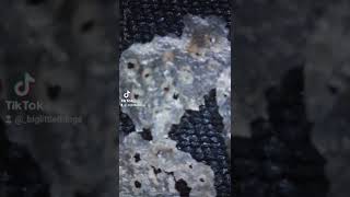 Dandruff under a 600x Microscope!