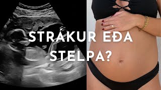 Strákur eða stelpa?