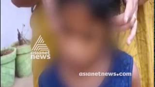 Stepmom burned daughter at karunagappily | FIR 24th JULY 2018