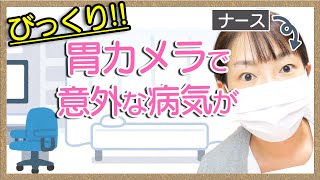 【胃カメラ】検査したら逆流性食道炎と〇〇が見つかった！！鼻からの胃カメラの様子を順番にお話します【看護師の不養生】