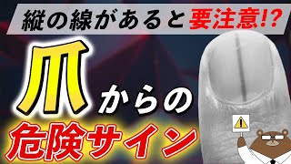 放置厳禁！知らないと後悔する「爪」からのSOSサイン。その知られざる意味とは？