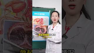 解密男性健康：阳痿是什么及其影响【悦活养生坊】#男性健康 #科普一下#医学科普 #实力持久硬对自如