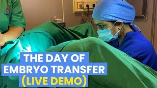 The Day of Embryo Transfer  (Live Demo) - Dr Asha Gavade Umang Hospital