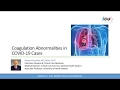 Coagulation Abnormalities in COVID 19 Patients