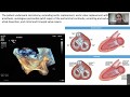 JACC: Case Reports Virtual Case Presentation | Transcatheter Interventions