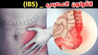 ماهو القولون العصبي؟! / !?What is Irritable Bowel Syndrome