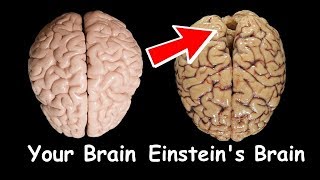 Your Brain vs Einstein's Brain?