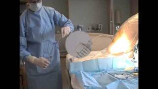 Gravity Flow Technique for Epidural Analgesia and Anesthesia