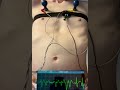 CRAZY heart on ECG🫀 Full video in description #boy #heart #shirtless #visible #heartbeat #ecg #body