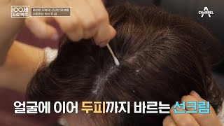 노력 끝에 풍성한 모발과 건강한 피부를 찾은 주인공! | 100세 프로젝트 141 회