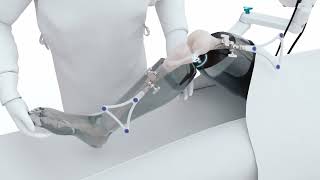 VELYS Robotic-Assisted Solution Video