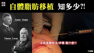 【雲說美學】自體脂肪移植 知多少?! 手術具體做法/步驟 是什麼?!