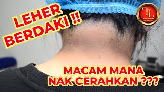 Rawatan Cerahkan Leher Gelap