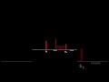 Mitral Valve Prolapse Heart Sound #heart #cardiology #heartsounds