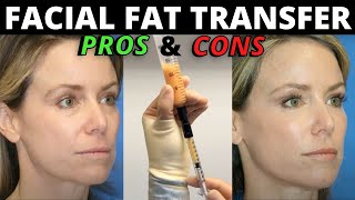 The Pros and Cons of Facial Fat Transfer from Facial Plastic Surgeon Dr. Amir Karam
