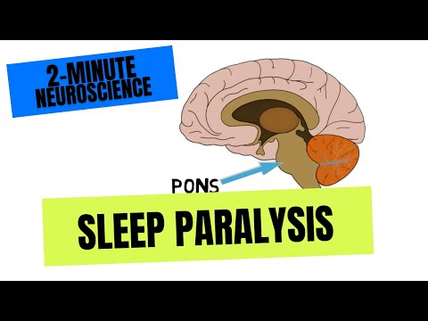 What triggers sleep paralysis?