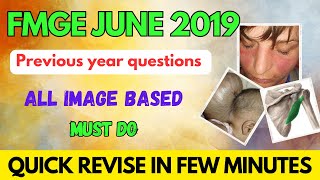 FMGE JUNE 2019 PREVIOUS YEAR image based questions revisions #fmge #neetpg #mbbs #next  #fmge2023