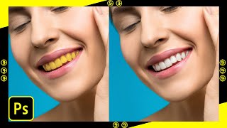 Realistic way to whiten teeth in photoshop #shorts