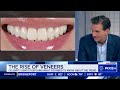 celebrity dentist explains rise of veneers