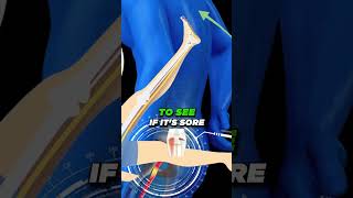 Sleeping Problems [ Sciatica can't Sleep]