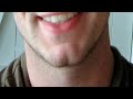 how to get rid of a cleft chin fast and easy