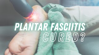 Can Plantar Fasciitis Be Cured? The Answer + Best Treatments!