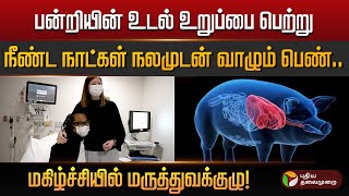 பன்றியின் உடல் உறுப்பை பெற்று நீண்ட நாட்கள் நலமுடன் வாழும் பெண்.. மகிழ்ச்சியில் மருத்துவக்குழு!