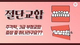 절단교합 - 주걱턱, 3급 부정교합 증상 중 하나라구요?? :: 절단교합 교정치과 - 서면교정치과/동래교정치과/미남교정치과/연산동교정치과/덕천교정치과