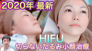 【HIFU 】2020年（顔、目まわり）スタッフさんが体験！