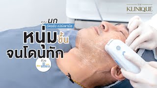 หนุ่มขึ้นจนโดน ด้วย Ulthera ที่ THE KLINIQUE นก ฉัตรชัย ปลื้มมาก