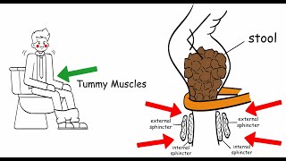 Anorectal Disorders and Problems Passing Stool