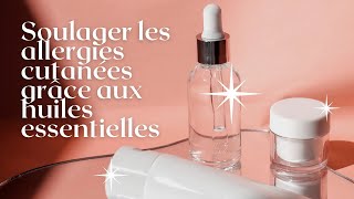 SOULAGER les ALLERGIES CUTANÉES ? Ces HUILES ESSENTIELLES vont te CHANGER la vie ! 🌿😱