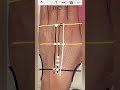 acupressure tcm byol point location part 6 by dr. pragyanshu pandey ub17 ub23 gv9 ub30 gv4...