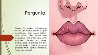 Estou com bolhas nos lábios com pus e arde muito | Meus lábios estão inchados | O que pode ser?