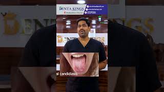 புற்றுநோய் வருவதற்கு முன்னதாகவே கண்டறிய முடியுமா? Pre-cancerous lesions and conditions. Denta kings